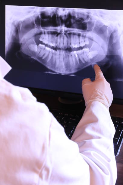 Best Broken or Chipped Tooth Repair in Pickens, MS